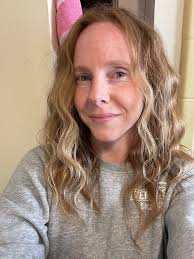 Waver purchase and burn injury