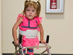 Oral Clefts May Stem From A Shared Genetic Cause As Neural Tube Defects Children S National