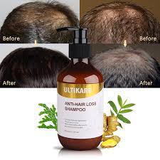 This means that hair growth can be boosted again with proper hair care. Natural 300ml Anti Hair Loss Dandruff Black Hair Shampoo With Blue Copper Peptide Professional Grow Thick Hair Growth Products Hair Loss Products Aliexpress