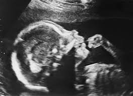 It's not business as usual”