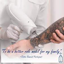 Honest opinions shared by friends and neighbors. Tattoo Removal Central Coast