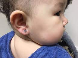 Clinical Ear Piercing For Infants Children And Adults In Dr Marina Klotsman S Medical Office