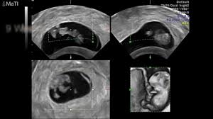 The weeks of the year in a gregorian calendar are Pregnancy 0 8 Weeks