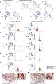 Price spike volatility volatile breakout breakouttrading breakoutsignal movement. Snake Venom Gland Organoids Sciencedirect