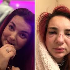 Christmas Eve turns into nightmare for couple assaulted at Chellaston bar