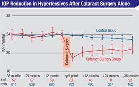 When Glaucoma Patients Have Cataract Surgery