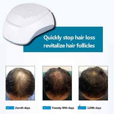 Another quality that sets this device apart. 650nm Laser Therapy Hair Growth Helmet Regrowth Device Anti Hair Loss Treatment Anti Hair Loss Promote Hair Regrowth Cap Massage Hair Loss Products Aliexpress