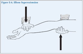 Image result for Elbow Extension Test