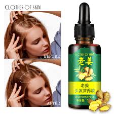 There are two ways to go about it. Ginger Hair Growth Essence 7 Days Hairdressing Hairs Mask Hair Essential Oil Care For Oil Dry And Damaged Hairs Nutrition Liquid Hair Loss Products Aliexpress