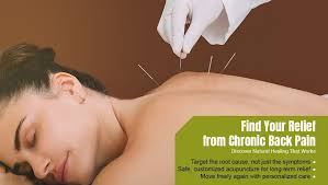 Middle Path Acupuncture