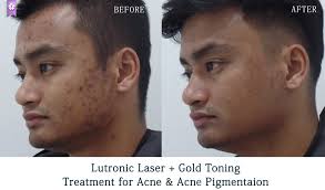 Beau & Hans Aesthetic