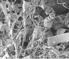 Image result for Bauhinia burrowsii