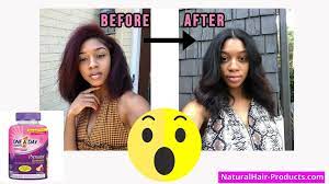 See Prenatal Vitamins Hair Growth Before And After Pictures Now