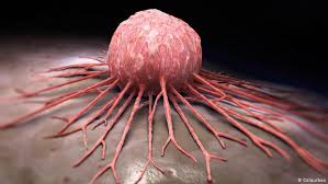 New research reveals a concerning rise in diagnoses, and. Dw S Health News Lifestyle Related Cancers On The Rise Science In Depth Reporting On Science And Technology Dw 13 06 2018