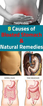 Most Common 8 Stomach Bloating Causes And Solution With Natural Remedies Bloated Stomach Stomach Swelling Bloating Causes
