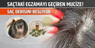 Sactaki Egzamayi Geciren Mucize 2021 Sac Dogal Sac Bakimi Dogal Cilt Bakimi