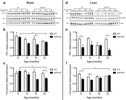 What will set off a metal detector? Marked Age Related Changes In Brain Iron Homeostasis In Amyloid Protein Precursor Knockout Mice Springerlink