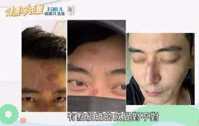 Freak accident: Taiwanese actor Norman Chen fell