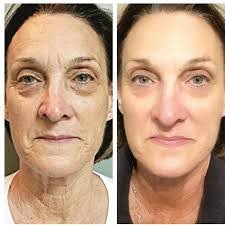 Marci Atkinson's Instagram, Twitter & Facebook