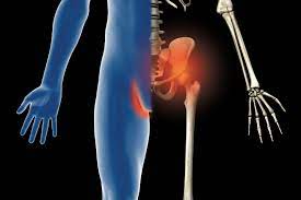 The doctor will ask about your symptoms, medical history, physical activity. Hip Pain Groin Strain Murray Fisher Canberra Chiropractor