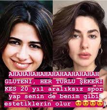 Bizim hikaye dizisinin oyuncuları, özel sahneleri ve diziden haberler bu sayfada. Nesrin Cavadzade Kimdir Estetikli Guzel Yorumlarina Cevap Verdi Elmaelma
