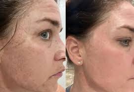 Leo Alba's Instagram, Twitter & Facebook