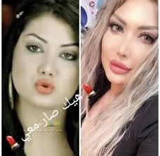 تعرضت منى الشداد لوعكة صحية فجائية، جعلتها تختفي من الوسط الفني والإعلام، حيث تم اكتشاف إصابتها منذ عام 2010 م، وبعد اتمام كافة الفحوصات قد تبين أنها مصابة بعدة أورام سرطانية، وكتل في أماكن مختلفة، كما تم استئصالها، في أحد المستشفيات في خارج البلاد بألمانيا، تماثلت الفنانة. ØµØ­Ø§ÙØ© Ù„Ø¨Ù†Ø§Ù† Ø¯Ø§Ù†Ø§ Ø¬Ø¨Ø± Ù‚Ø¨Ù„ Ø§Ù„ØªØ¬Ù…ÙŠÙ„ Ù„Ø§ Øª Ø¹Ø±Ù ØµÙˆØ±Ø©