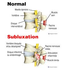 Maybe you would like to learn more about one of these? Qu Est Ce Qui Craque Chez Le Chiro Monchiro Ca Votre Chiropraticien Au Quebec On S Occupe De Vous