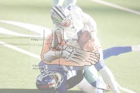 The following images shown on the cbs broadcast that show prescott's injury are. Ok So You Have A Severe Ankle Injury Now What A Possible Look Of Dak Prescott S Next Several Months Greater Washington Advanced Podiatry Llc