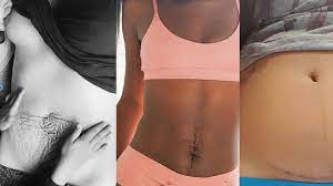 Check spelling or type a new query. After Baby Body Echte Mamas