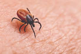 Image result for Lyme Carditis