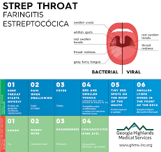 Image result for Strep throat infection roof of mouth