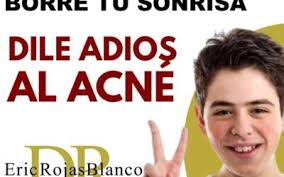 Mejora la sudoración de las axilas.