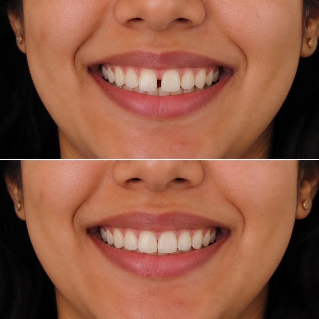 Cosmetic Dentistry in Baba Nagar Colony product image