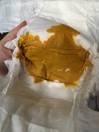 What can i do for him? Normal Ebf Baby Poo Or Diarrhoea Warning Contains Pic Mumsnet