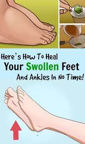 Pin On Health And Beauty Tips