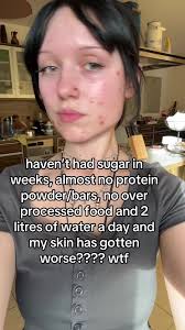 help #foryou #fypシ #viral_video