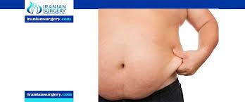 Overall, sono bello laser liposuction has positive reviews but possible side effects should be considered. How Much Is Liposuction Of The Stomach And Love Handles Review Video