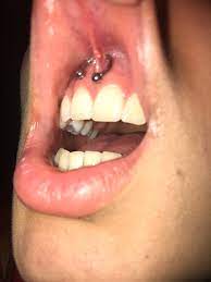 I Got A Smiley Piercing Today And It Doesn T Show When I Smile And The Dude Didn T Even Tell Me To Breathe In Or Out And Just Did It And It Hurt
