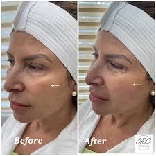 Eileen Ruiz-Cruz, APRN