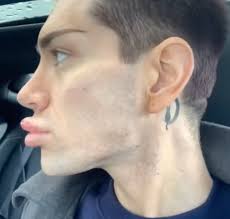 A Man Shows Off His Plastic Surgery Results, and It Shocks People