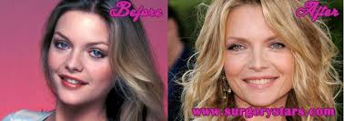 · she sticks to clean . Michelle Pfeiffer Plastic Surgery Before And After Shoots