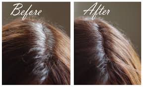 Dry shampoo can serve as a hair refresher, letting you extend the life of a blowout. Dark Brown Hair Powder Saving Grace Hair