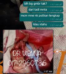 Monoamine oxidase harga pil cytotec original is a key enzyme for serotonin, dopamine and norepinephrine inactivation. Dr Gugur Kandungan 0172960736 Dr Gugur Twitter