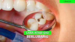 Penyebab sakit perut saat haid. Cara Jitu Mengatasi Sakit Gigi Berlubang Tanpa Obat Dokter
