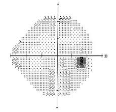 Image result for Visual Fixation