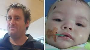 Strangers rally for bashed baby Bobby