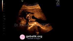 17 haftalik gebelik