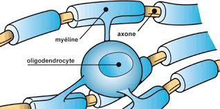 Vous souffrez de sclérose en plaques et souhaitez enfin trouver des informations fiables ? Vers Un Traitement De La Sclerose En Plaques D Emblee Progressive Handicap Infos
