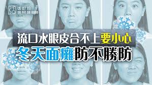 面癱，通常是一條神經線受影響，因而半邊面癱。 邊臉肌肉活動受影響。時曾患貝爾氏麻痹，令他右前加拿大總理克雷蒂安年輕 美國一位著名耳科專家william house將顏面神經癱瘓的嚴重程度分為六級： 等級 皺眉喪失 閉眼 嘴巴歪斜 1 極輕 正常 正常 æµå£æ°´çœ¼çš®åˆä¸ä¸Šè¦å°å¿ƒå†¬å¤©é¢ç™±é˜²ä¸å‹é˜² æ´»å¥½çš„so Fit So Good Line Today